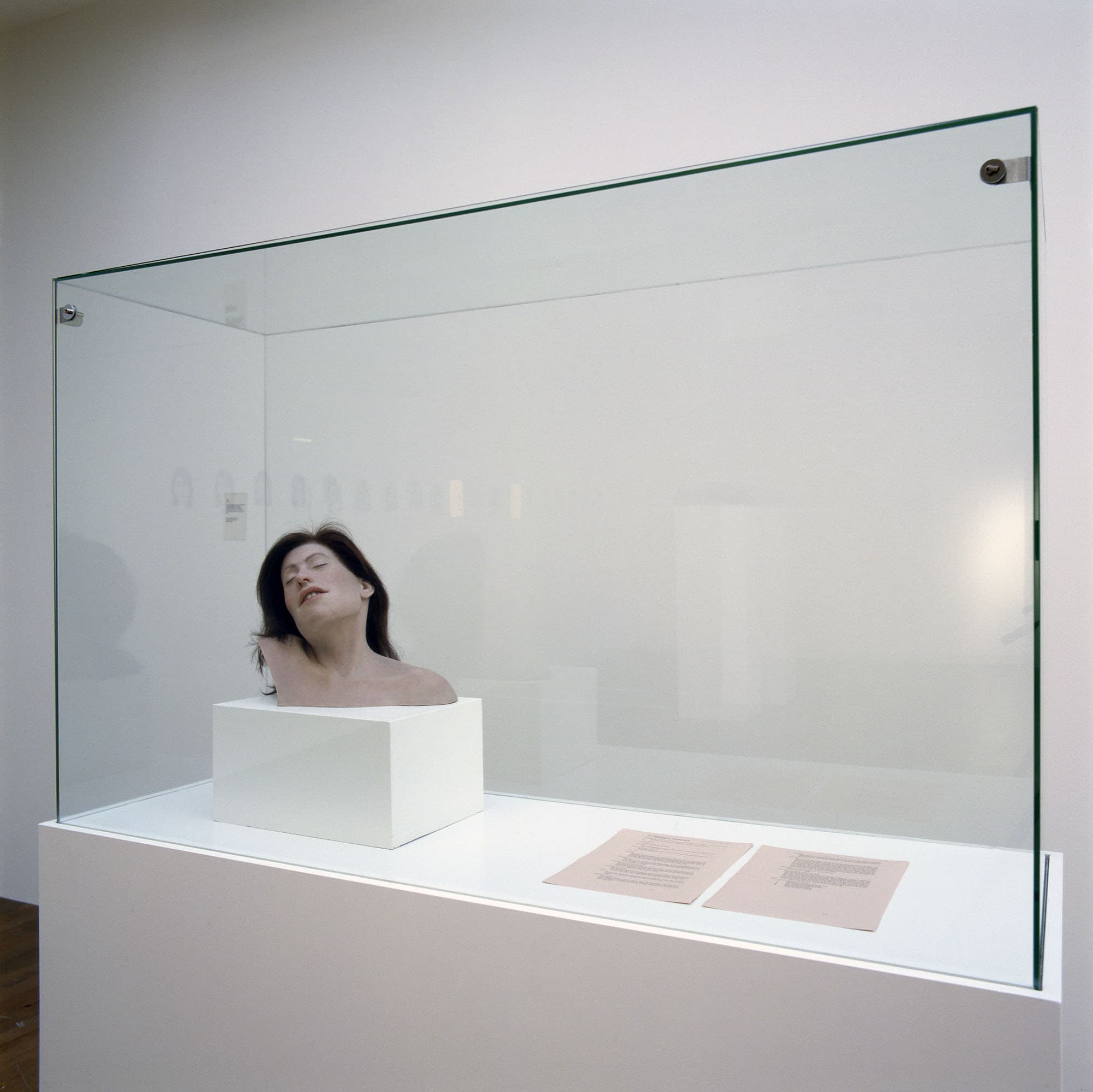Head. Facial Reconstruction and Forensic Report. 2005