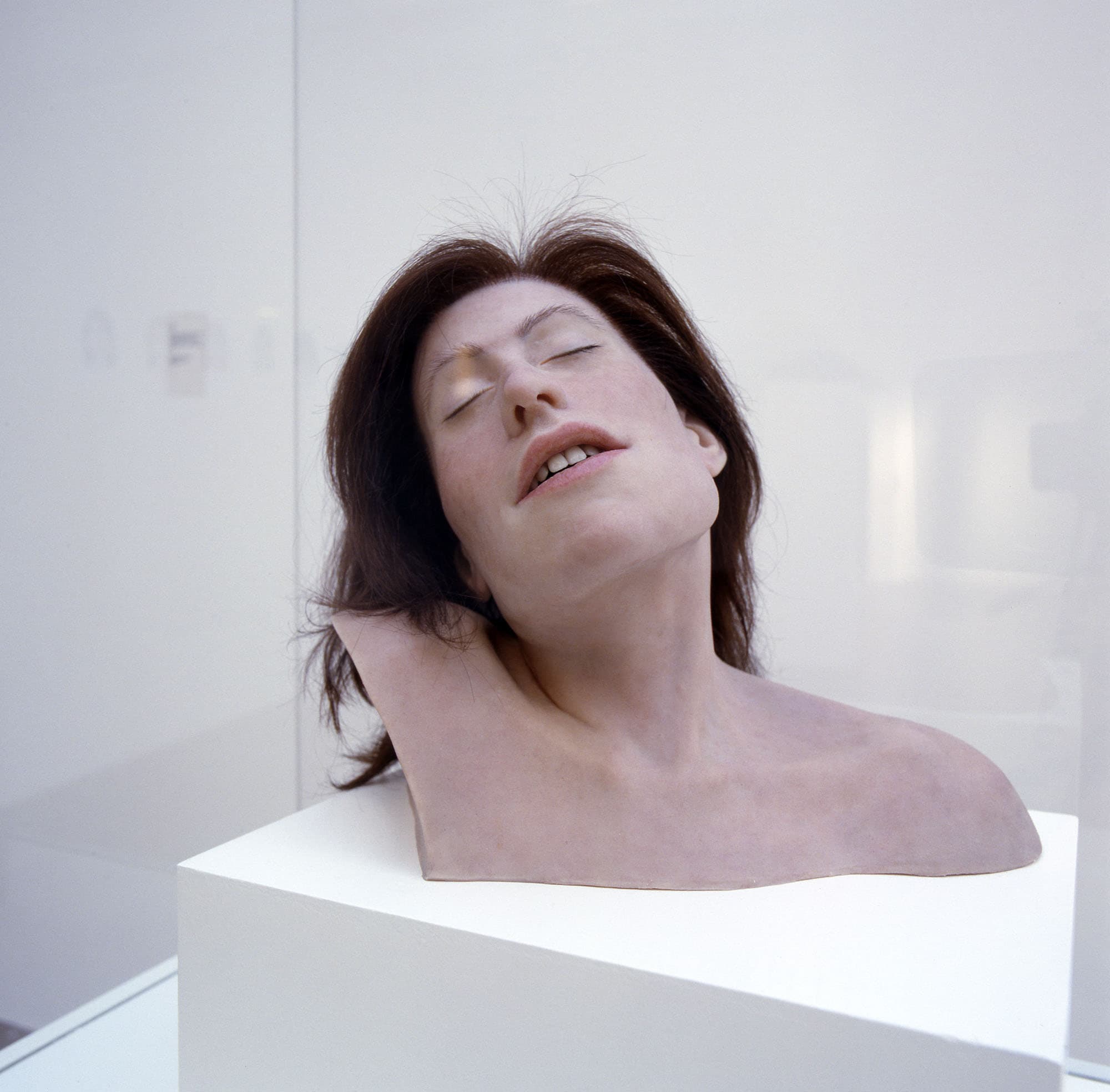 Head. Facial Reconstruction and Forensic Report. 2005