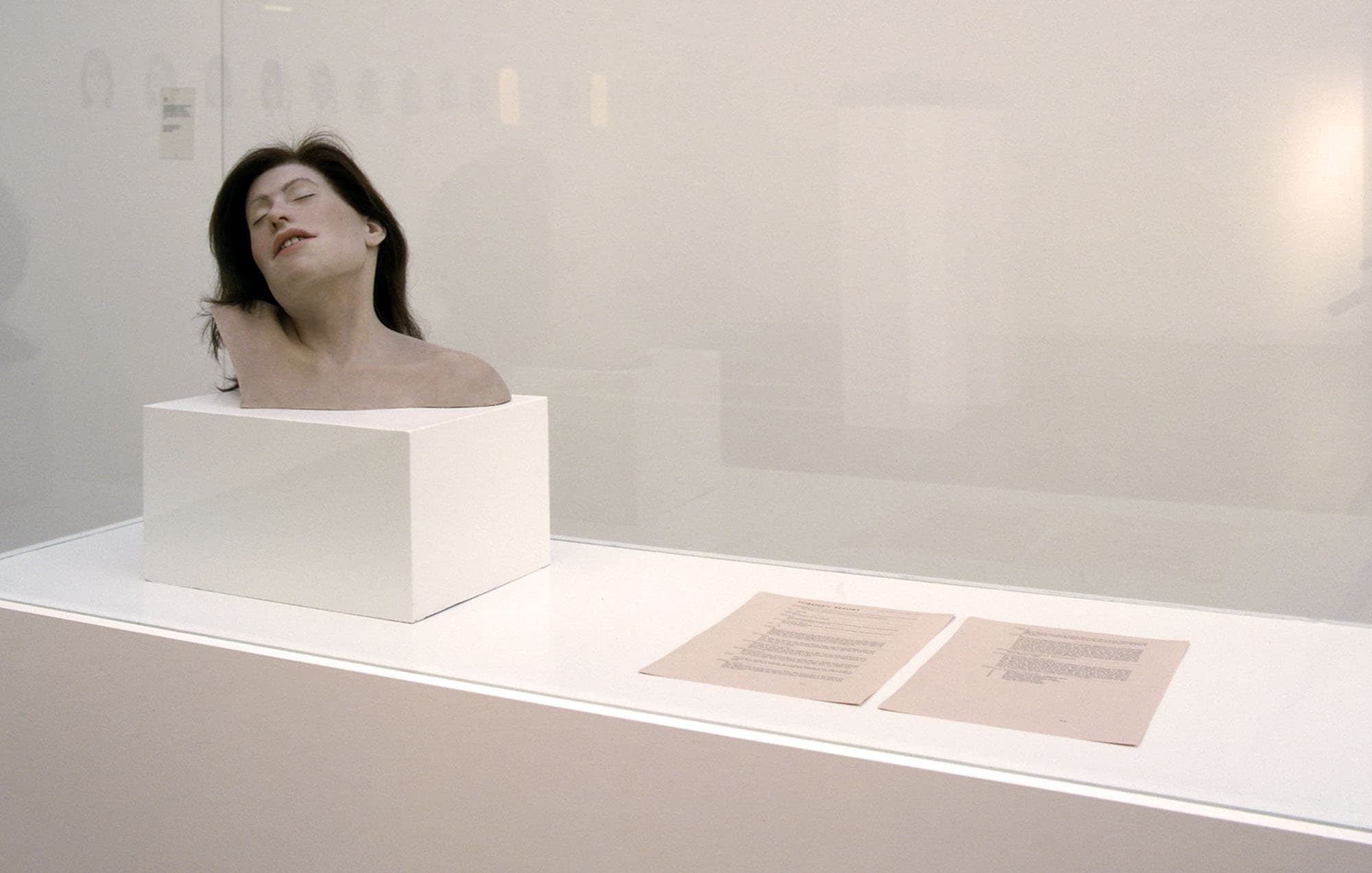 Head. Facial reconstruction and forensic report. 2005