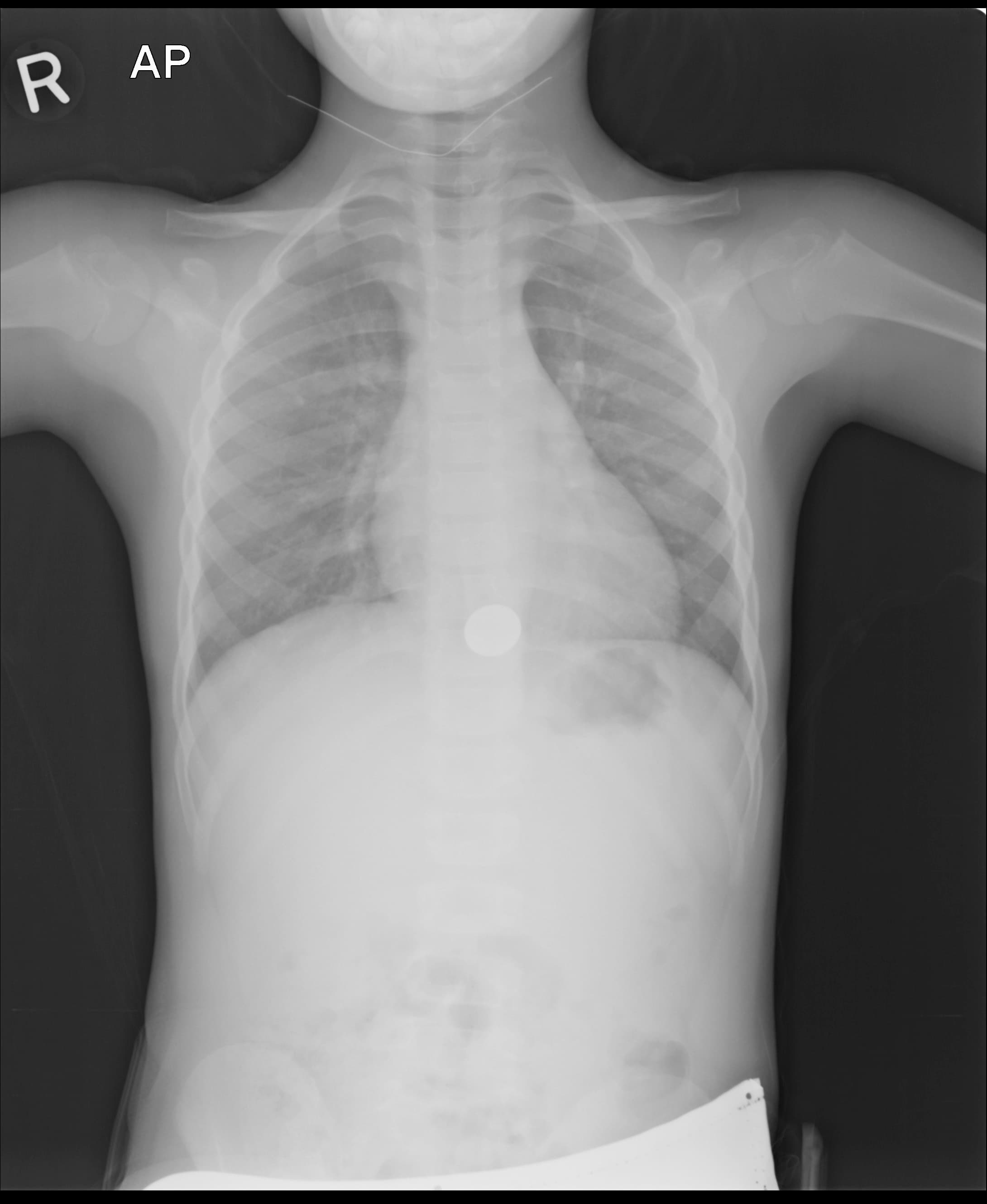 Tender: Balance, image 12